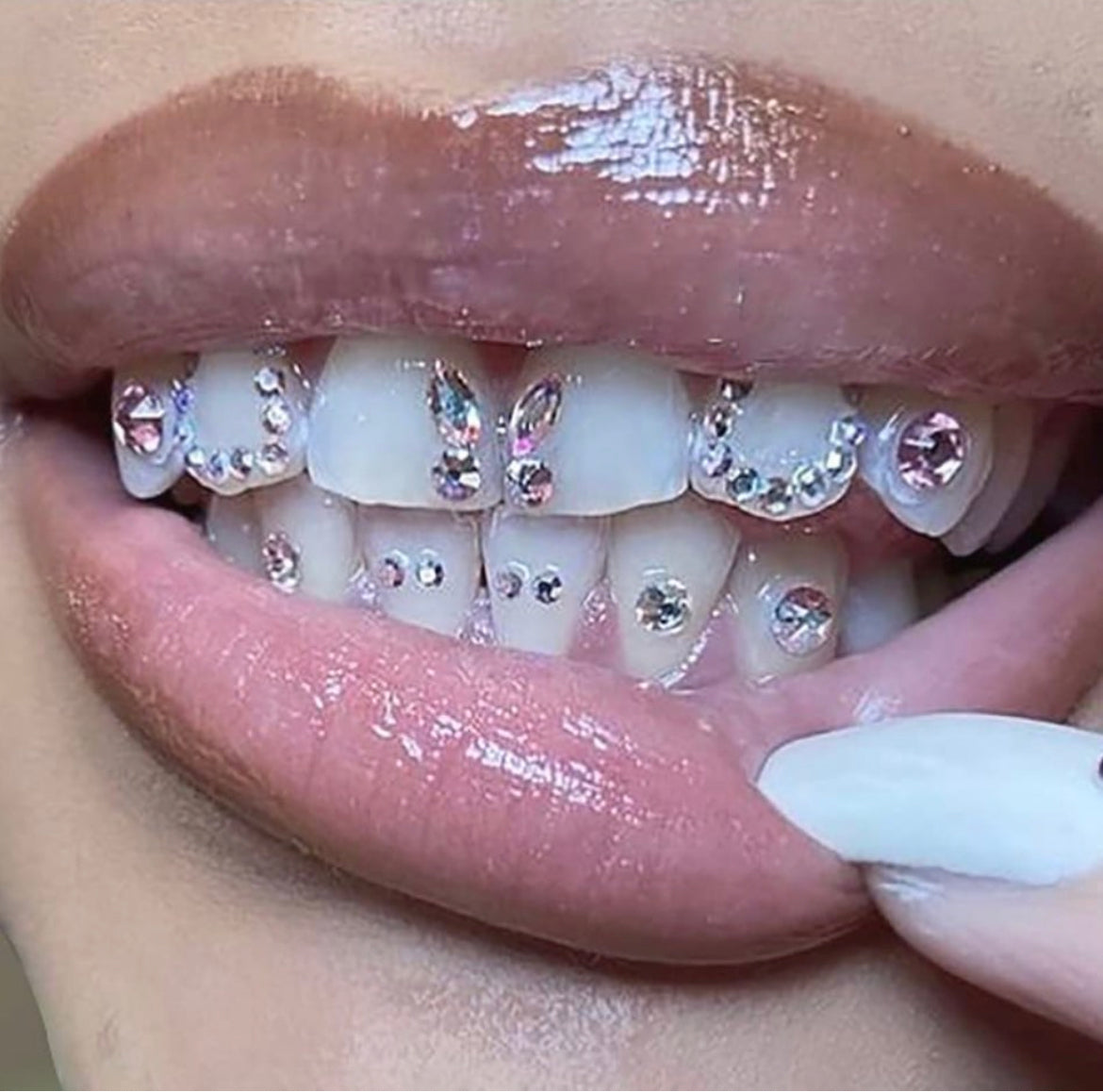 TOOTH GEMS TEETH WHITENING APPOINTMENTS 